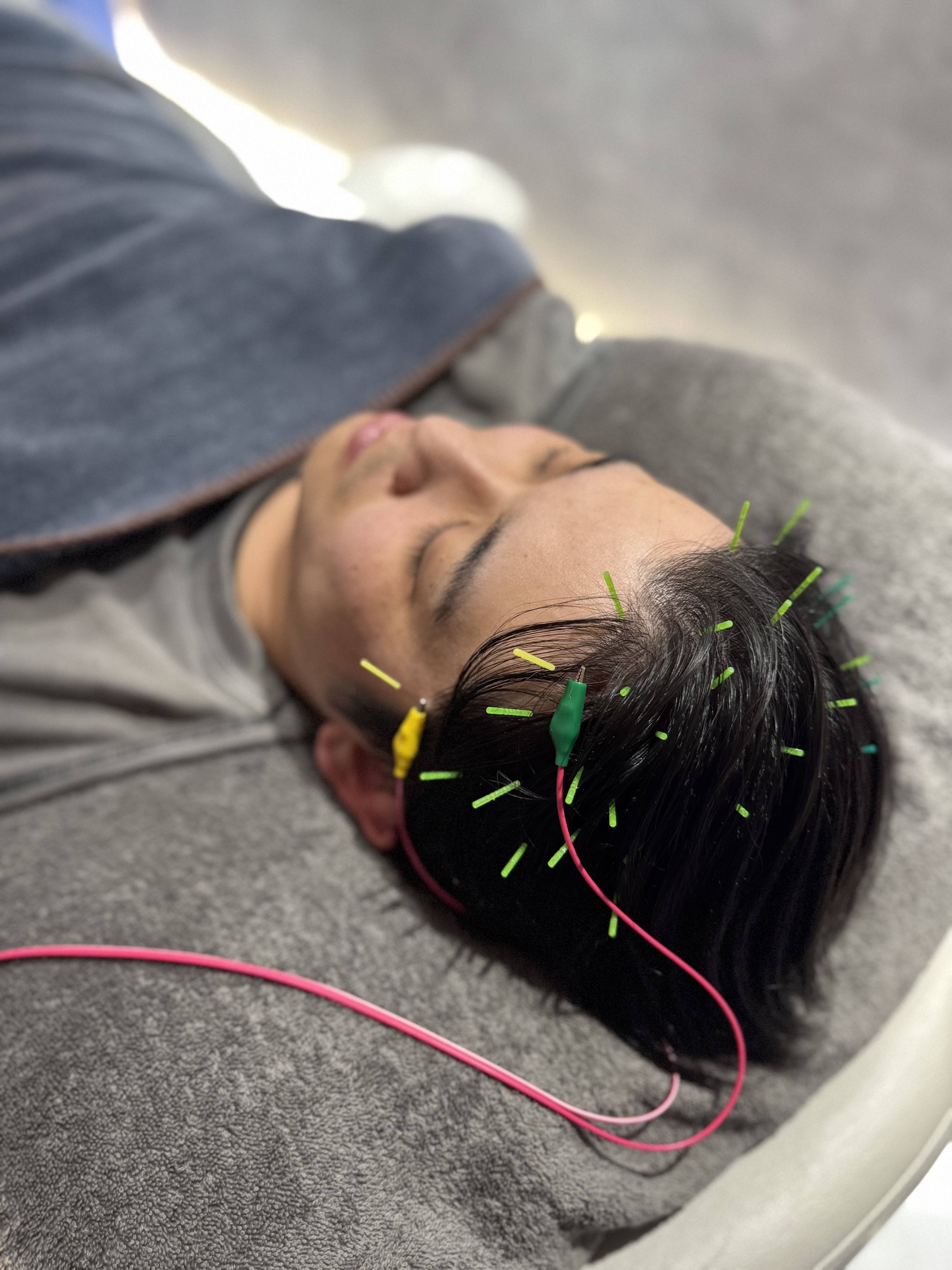 脳と神経へのアプローチを表現したBRAIN CLASSのイメージ